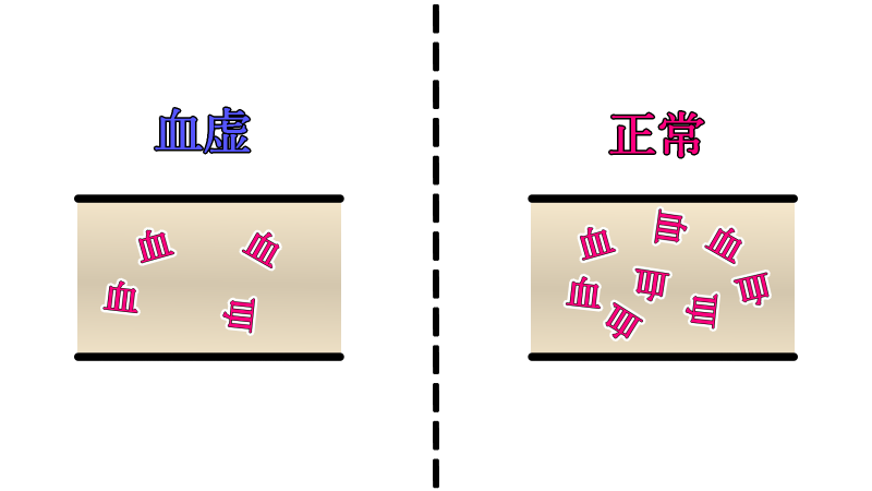 kekkyo