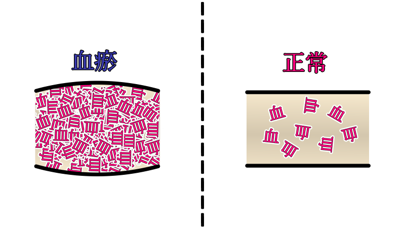 ketsuo