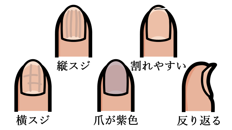 nail