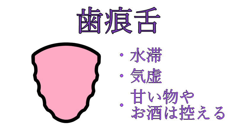 shikonzetsu